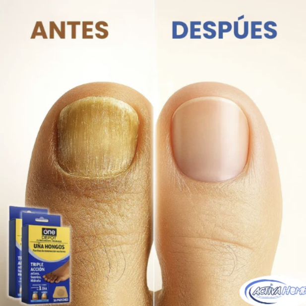 NailFix® 2x1 - Parches Anti-Hongos